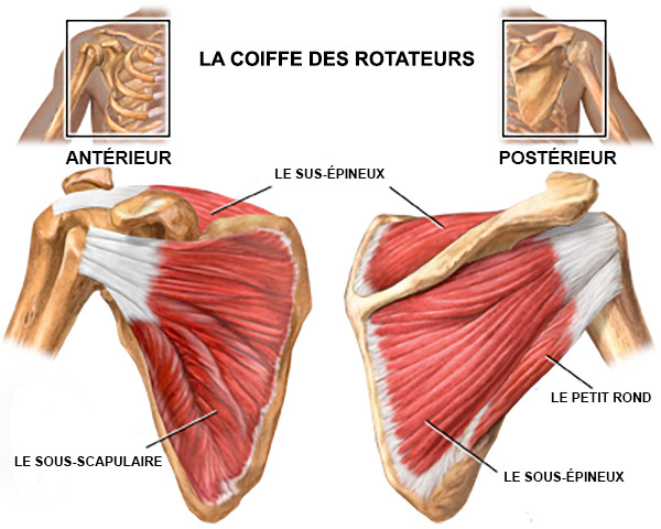 Rupture coiffe des rotateurs CHA